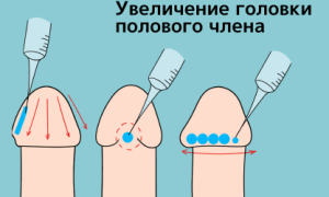 Увеличение члена: действительно ли размер решает для уверенности?