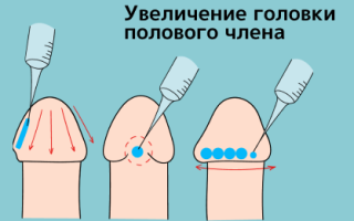 Увеличение члена: действительно ли размер решает для уверенности?