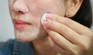 Причины появления комедонов и как избавиться от черных точек на коже