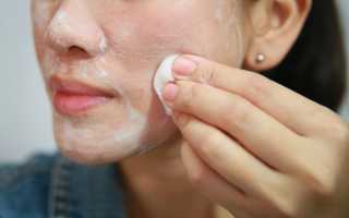 Причины появления комедонов и как избавиться от черных точек на коже