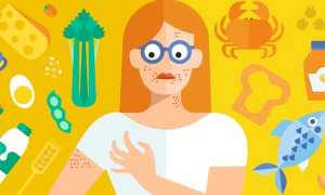 Безопасные способы как избавиться от аллергии навсегда и улучшить здоровье