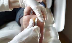 Практические способы как избавиться от мозолей на ногах