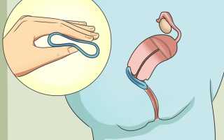 Новаринг – отзывы девушек о вагинальном кольце и его особенностях