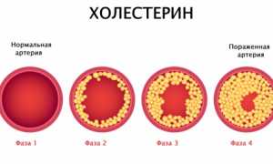 Какие продукты содержат большое количество холестерина?