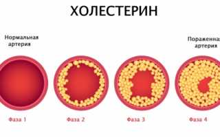 Какие продукты содержат большое количество холестерина?