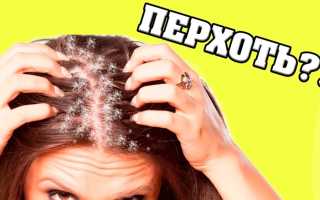 Эффективные способы борьбы с перхотью в домашних условиях для здоровья кожи