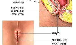 Меняется ли анус после анала? Узнайте подробности