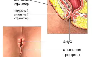 Меняется ли анус после анала? Узнайте подробности
