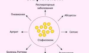 Как победить стафилококковую инфекцию: советы и рекомендации