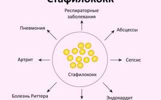 Как победить стафилококковую инфекцию: советы и рекомендации