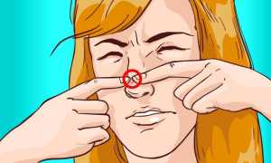 Запретное удовольствие: почему люди любят давить прыщи и что это значит