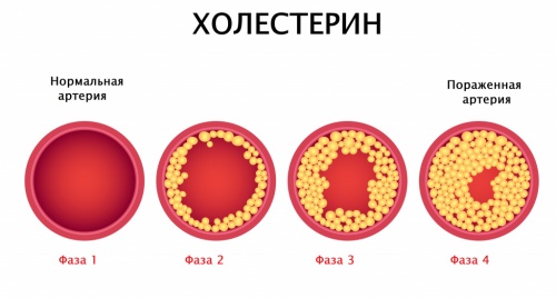 холестерин
