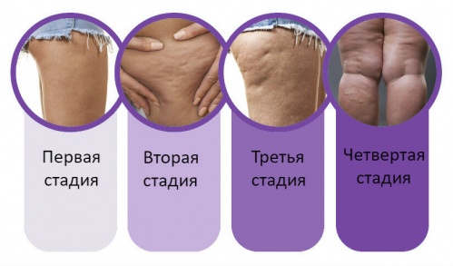 Как избавиться