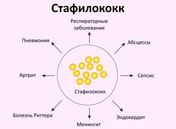 Как победить стафилококк