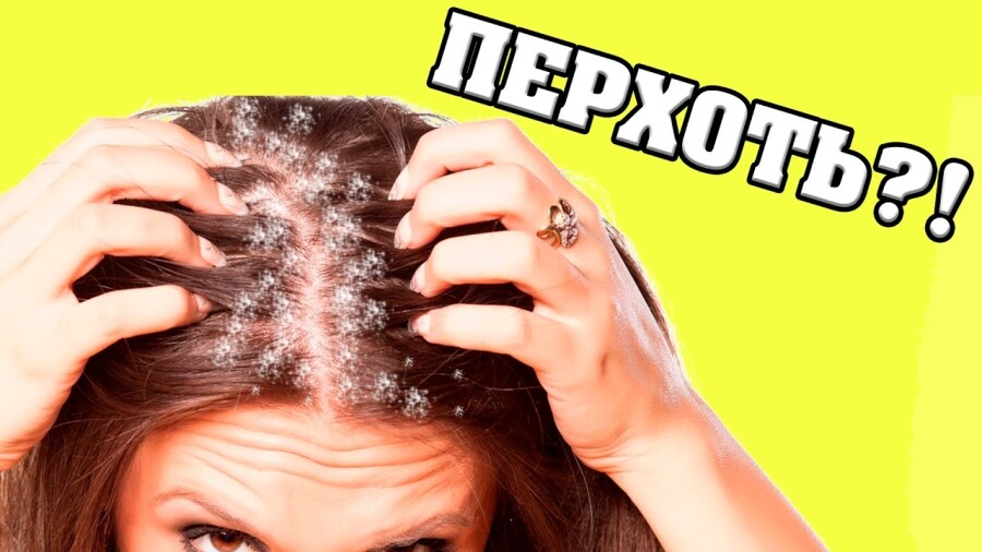 способы борьбы с перхотью
