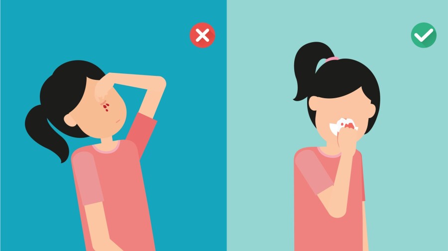 причины носового кровотечения